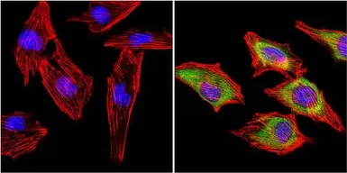 Anti-MUSK antibody used in Immunocytochemistry/ Immunofluorescence (ICC/IF). GTX25619