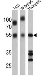 Anti-Thyroid Hormone Receptor alpha antibody used in Western Blot (WB). GTX25621