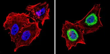 Anti-Thyroid Hormone Receptor alpha antibody used in Immunocytochemistry/ Immunofluorescence (ICC/IF). GTX25621