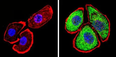 Anti-Thyroid Hormone Receptor alpha antibody used in Immunocytochemistry/ Immunofluorescence (ICC/IF). GTX25621