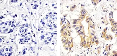 Anti-PKC delta (phospho Ser664) antibody used in IHC (Paraffin sections) (IHC-P). GTX25658