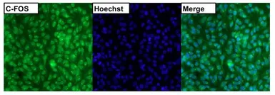 Anti-c-Fos antibody used in Immunocytochemistry/ Immunofluorescence (ICC/IF). GTX25794