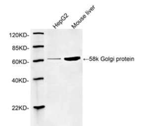Anti-58K Golgi protein antibody used in Western Blot (WB). GTX25820