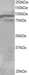 Anti-OSBPL11 antibody, C-term used in Western Blot (WB). GTX25934