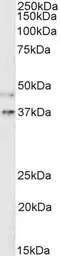 Anti-Renin Receptor antibody used in Western Blot (WB). GTX25959