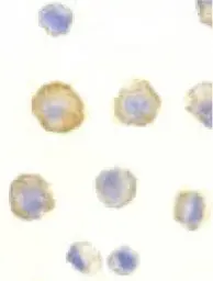 Anti-DcR1 antibody used in Immunocytochemistry/ Immunofluorescence (ICC/IF). GTX25975
