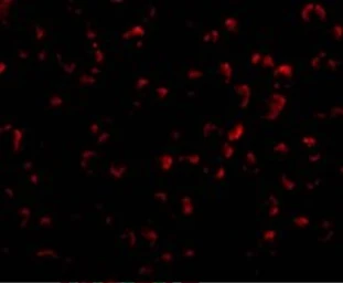 Anti-DEDAF antibody used in Immunocytochemistry/ Immunofluorescence (ICC/IF). GTX25976