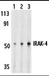 Anti-IRAK4 antibody used in Western Blot (WB). GTX25985