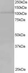 Anti-RanBP16 antibody, C-term used in Western Blot (WB). GTX26041