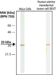 Anti-CDK4 antibody [DCS-31] used in Western Blot (WB). GTX26315