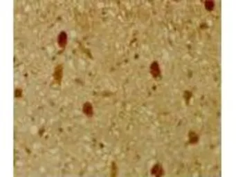 Anti-Rb2 / p130 antibody used in IHC (Paraffin sections) (IHC-P). GTX26545