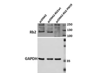Anti-Rb2 / p130 antibody used in Western Blot (WB). GTX26545