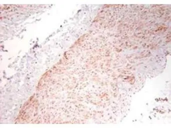Anti-TNF alpha antibody used in IHC (Paraffin sections) (IHC-P). GTX26671