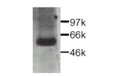Anti-CTGF antibody used in Western Blot (WB). GTX26992