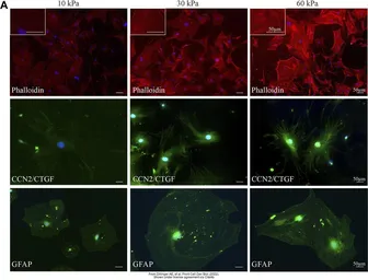 Anti-CTGF antibody used in Immunocytochemistry/ Immunofluorescence (ICC/IF). GTX26992