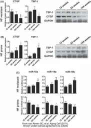 Anti-CTGF antibody used in Western Blot (WB). GTX26992