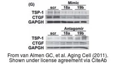 Anti-CTGF antibody used in Western Blot (WB). GTX26992
