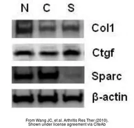 Anti-CTGF antibody used in Western Blot (WB). GTX26992