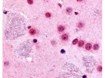 Anti-Gli2 antibody used in IHC (Paraffin sections) (IHC-P). GTX27195