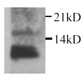 Anti-IL15 antibody used in Western Blot (WB). GTX27215
