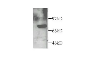 Anti-MMP2 antibody used in Western Blot (WB). GTX27298