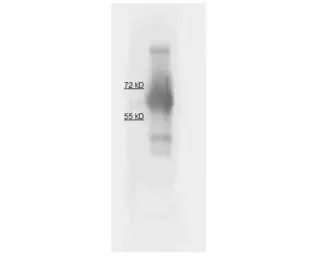 Anti-Calf intestinal Alkaline Phosphatase antibody used in Western Blot (WB). GTX27325