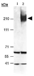Anti-ABCA1 antibody used in Western Blot (WB). GTX27360