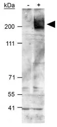 Anti-ABCA1 antibody used in Western Blot (WB). GTX27360