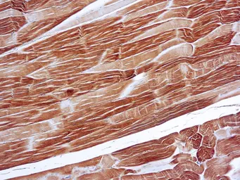 Anti-alpha Sarcomeric Actin antibody [5C5] used in IHC (Paraffin sections) (IHC-P). GTX27799