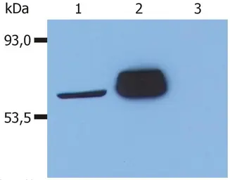 Anti-Lck antibody [LCK-01] used in Western Blot (WB). GTX28075
