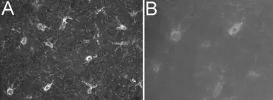 Anti-S100 antibody [8B10] used in Immunohistochemistry (IHC). GTX28330