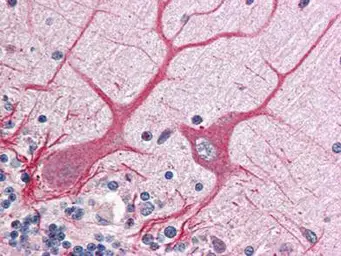 Anti-NOTCH1 antibody used in IHC (Paraffin sections) (IHC-P). GTX28387
