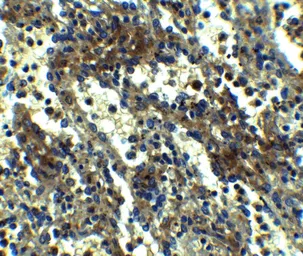 Anti-TMS1 antibody used in IHC (Paraffin sections) (IHC-P). GTX28394