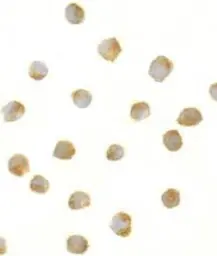 Anti-DFFB antibody used in Immunocytochemistry/ Immunofluorescence (ICC/IF). GTX28406