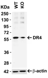 Anti-DR4 antibody used in Western Blot (WB). GTX28414