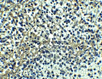 Anti-DR4 antibody used in IHC (Paraffin sections) (IHC-P). GTX28414