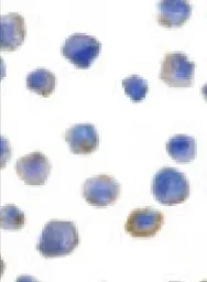 Anti-FLIP antibody used in Immunocytochemistry/ Immunofluorescence (ICC/IF). GTX28421