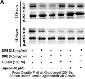 Anti-FLIP antibody used in Western Blot (WB). GTX28421