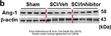 Anti-Angiopoietin 1 antibody used in Western Blot (WB). GTX28451