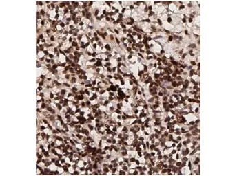 Anti-AKT (phospho Thr308) antibody used in IHC (Paraffin sections) (IHC-P). GTX28933