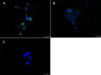 Anti-PPAR alpha antibody used in Immunocytochemistry/ Immunofluorescence (ICC/IF). GTX28934