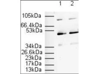 Anti-PPAR alpha antibody used in Western Blot (WB). GTX28934