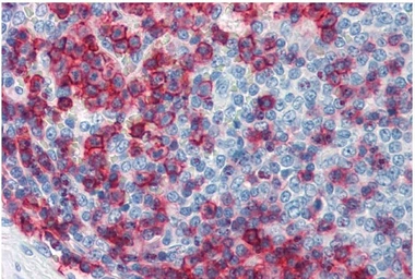 Anti-CD43 antibody [MEM-59] used in IHC (Paraffin sections) (IHC-P). GTX29088