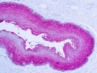 Anti-pan Cytokeratin antibody used in IHC (Paraffin sections) (IHC-P). GTX29377