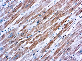 Anti-sarcomeric alpha Actinin antibody [EA-53] used in IHC (Paraffin sections) (IHC-P). GTX29465