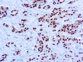 Anti-Androgen Receptor antibody [AR 441] used in IHC (Paraffin sections) (IHC-P). GTX29474