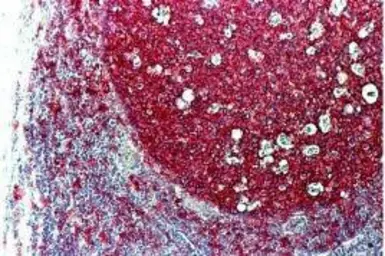 Anti-CD20 antibody [L26] used in IHC (Paraffin sections) (IHC-P). GTX29475