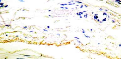 Anti-Elastin antibody [BA-4] used in IHC (Paraffin sections) (IHC-P). GTX29519