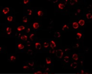 Anti-PUMA antibody used in Immunocytochemistry/ Immunofluorescence (ICC/IF). GTX29643
