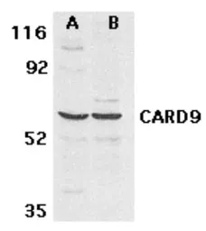 Anti-CARD9 antibody used in Western Blot (WB). GTX29649